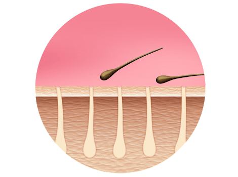 Philips Krok2 Bri958 Ikona Roz Numer